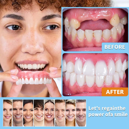 Natural-Looking Smile, Easy At-Home Fit